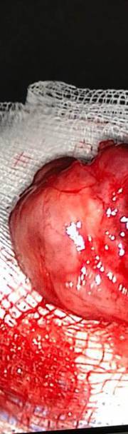 Photos of Minimal Access ENT Surgery Minimal access ENT surgery